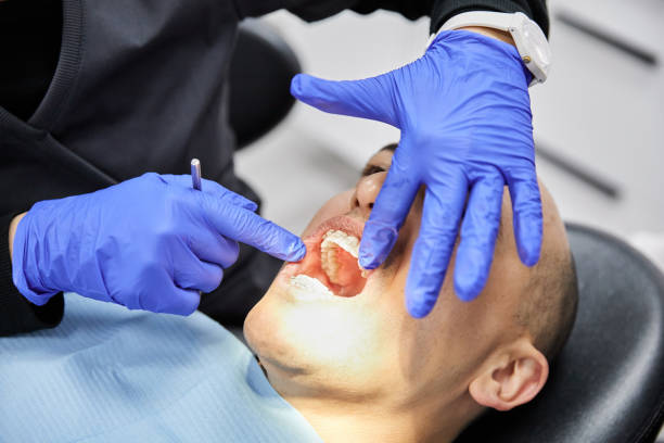 Best Emergency Tooth Extraction in Barberton, OH